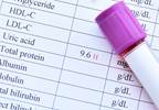 Uric Acid Predicts AKI Risk After Cardiac Surgery Uric Acid Predicts AKI Risk After Cardiac Surgery