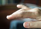 TNFi Not Linked to Increased Cancer Recurrence in RA Patients TNFi Not Linked to Increased Cancer Recurrence in RA Patients