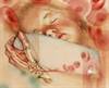 Juvenile Spondyloarthritis: Classification and Treatment Considerations Juvenile Spondyloarthritis: Classification and Treatment Considerations