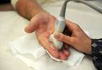 Ultrasonographic Synovial Involvement Frequent in Systemic Sclerosis Ultrasonographic Synovial Involvement Frequent in Systemic Sclerosis