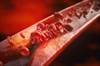 Atherosclerosis Progression Differs According to Timing of Estradiol Therapy After Menopause Atherosclerosis Progression Differs According to Timing of Estradiol Therapy After Menopause