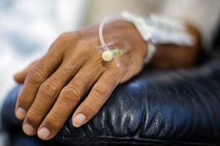 Clinicians should be aware that certain cancer chemotherapeutics may have side effects that could mimic RA symptoms. Clinicians should be aware that certain cancer chemotherapeutics may have side effects that could mimic RA symptoms.