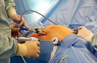 Although bariatric surgery is the most effective treatment strategy for severe obesity, there is a dearth of research regarding the effects of this procedure on patients with gout. Although bariatric surgery is the most effective treatment strategy for severe obesity, there is a dearth of research regarding the effects of this procedure on patients with gout.