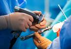 Incidence, Predictors of Orthopedic Surgery in Psoriatic Arthritis Incidence, Predictors of Orthopedic Surgery in Psoriatic Arthritis