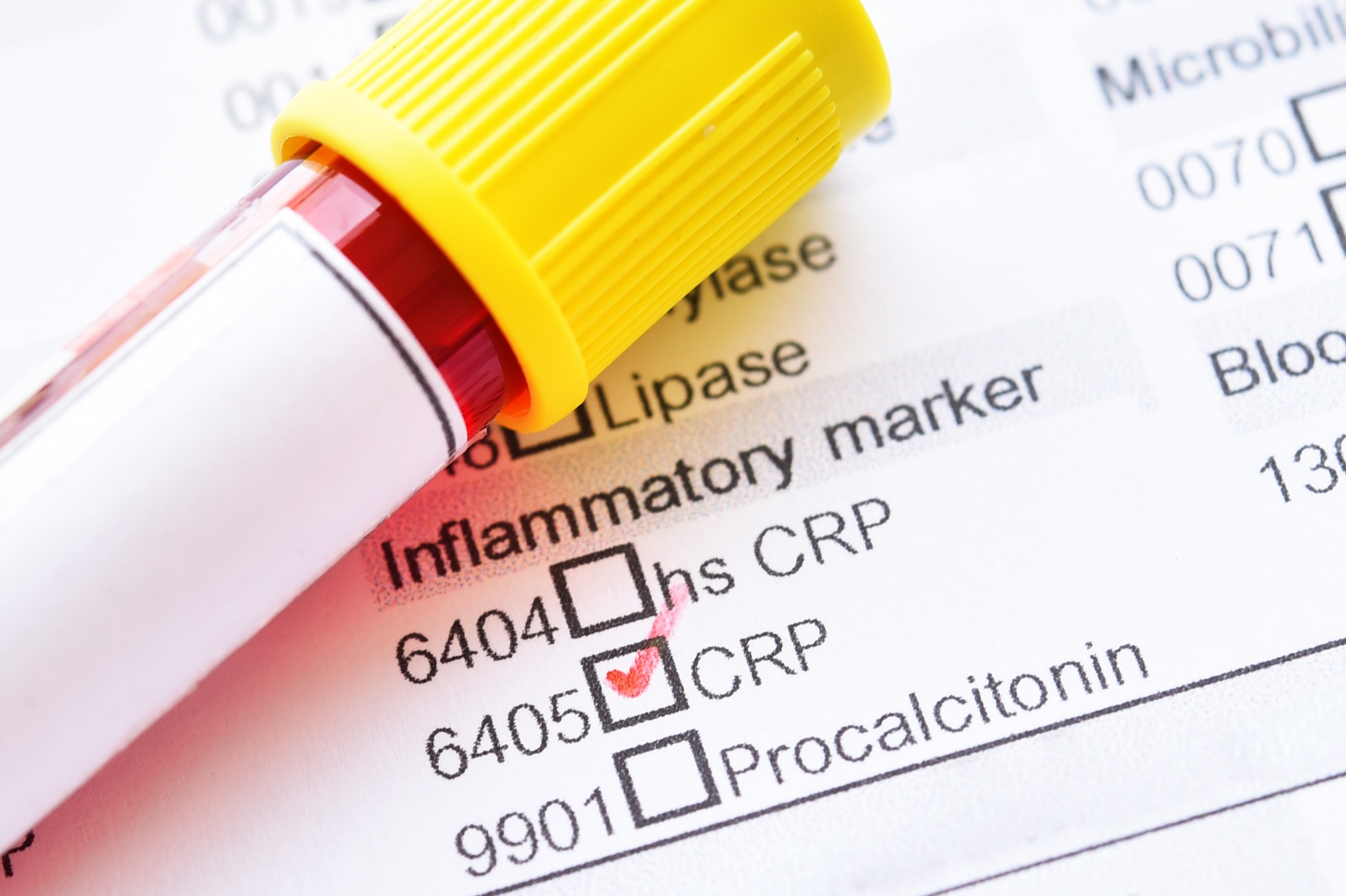 High C Reactive Protein And Low Blood Pressure