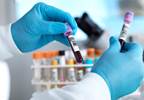 Increased Levels of Plasma Leukotriene B<sub>4</sub> Found in Acute Gout Increased Levels of Plasma Leukotriene B<sub>4</sub> Found in Acute Gout