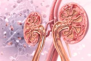 Data indicate that gout is a risk factor for incident CKD stage ≥3. Data indicate that gout is a risk factor for incident CKD stage ≥3.