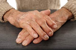 ICHOM has released a set of outcomes to enable the implementation of value-based health care for patients with inflammatory arthritis. ICHOM has released a set of outcomes to enable the implementation of value-based health care for patients with inflammatory arthritis.