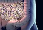 Inflammatory Arthritis and the Gut Microbiome: Do Microbes Hold the Key to New Treatments? Inflammatory Arthritis and the Gut Microbiome: Do Microbes Hold the Key to New Treatments?