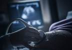 Intrauterine Fetal Death Associated With Antiphospholipid Syndrome Intrauterine Fetal Death Associated With Antiphospholipid Syndrome