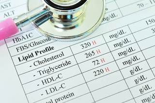 Data show that primary lipid screening rates were suboptimal in patients with RA. Data show that primary lipid screening rates were suboptimal in patients with RA.