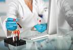 Improving RA Diagnosis With Use of Anti-ACPAs Improving RA Diagnosis With Use of Anti-ACPAs