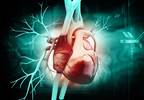 Antimalarial-Induced Cardiomyopathy May Be Underrecognized in Systemic Lupus Erythematosus Antimalarial-Induced Cardiomyopathy May Be Underrecognized in Systemic Lupus Erythematosus