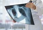 Connective Tissue Disease-Associated Interstitial Lung Disease: Unmet Needs and Challenges Connective Tissue Disease-Associated Interstitial Lung Disease: Unmet Needs and Challenges