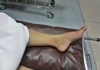 Factors Associated With Bone Erosion Identified in Gout Factors Associated With Bone Erosion Identified in Gout