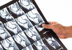 No Benefit for MRI-Guided Treat-to-Target Strategy in Rheumatoid Arthritis No Benefit for MRI-Guided Treat-to-Target Strategy in Rheumatoid Arthritis