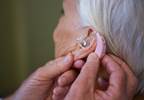 Psoriatic Arthritis Linked to Increased Risk for Hearing Loss Psoriatic Arthritis Linked to Increased Risk for Hearing Loss