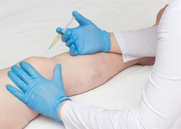 Intra-articular Agents in Knee OA: Treatment Options and Future Developments Intra-articular Agents in Knee OA: Treatment Options and Future Developments